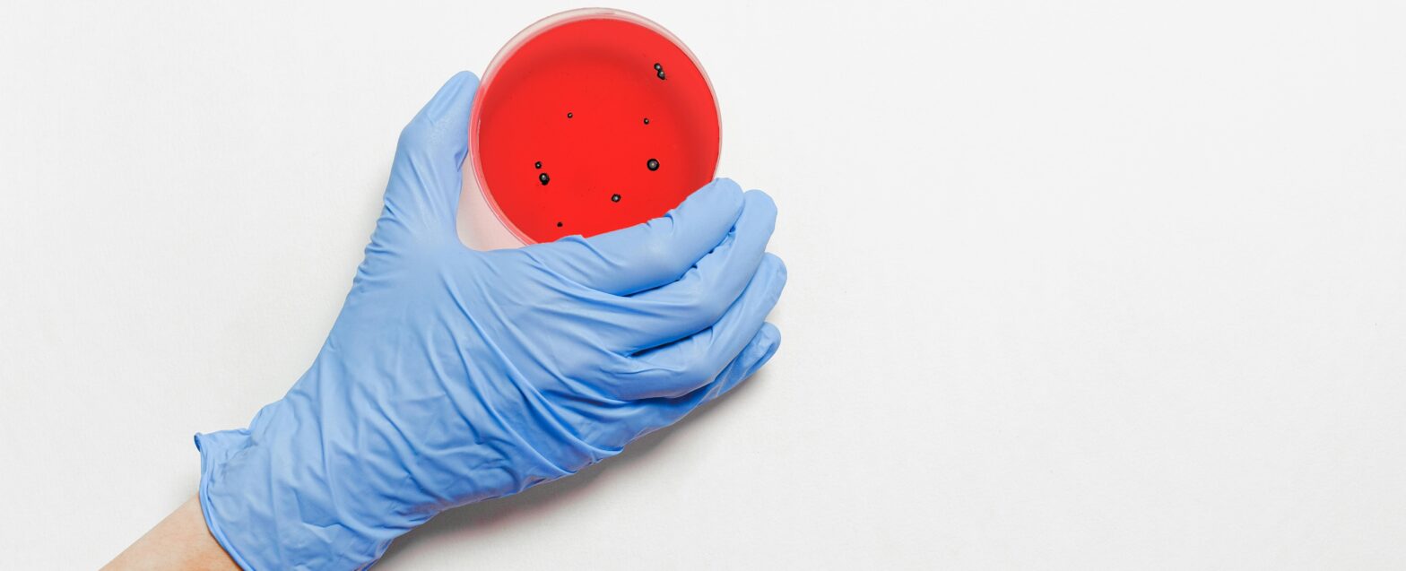 Enfermedades infecciosas - jorge zegarra reategui denuncia